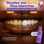 Load image into Gallery viewer, Mousse Blanchiment Dents - Dents Blanches en 7 Jours - Anti-Taches et Anti-Mauvaise Haleine
